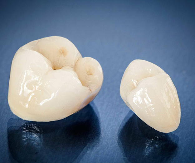 Dental crowns displayed on blue surface showing tooth-colored ceramic restorations.