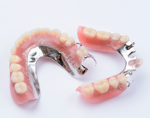 Partial dentures with metal clasps displayed on white background showing dental prosthetic components.