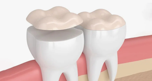 Two tooth illustrations with cloud-shaped crowns on pink gum background for dental website.