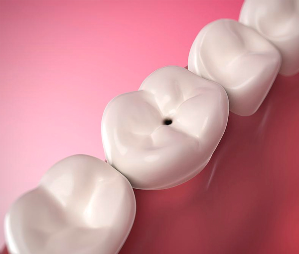 White dental crowns or tooth models arranged diagonally against pink background.