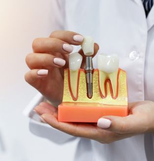 Dental Implants Henderson
